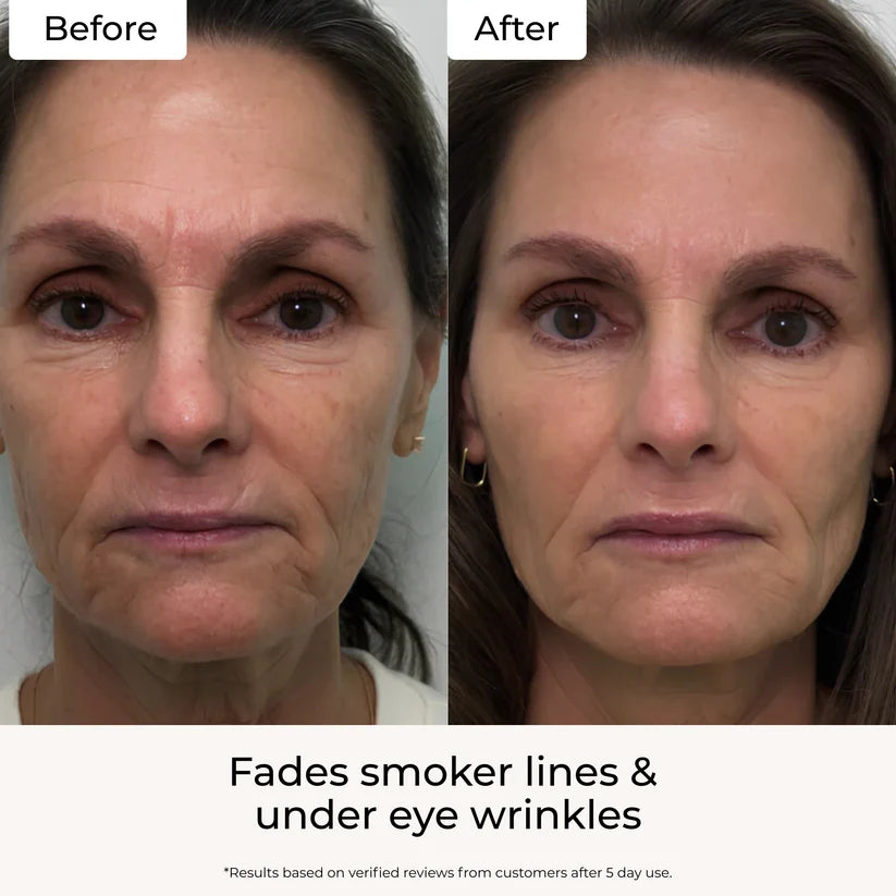 Auna Targeted Fine Line Primer