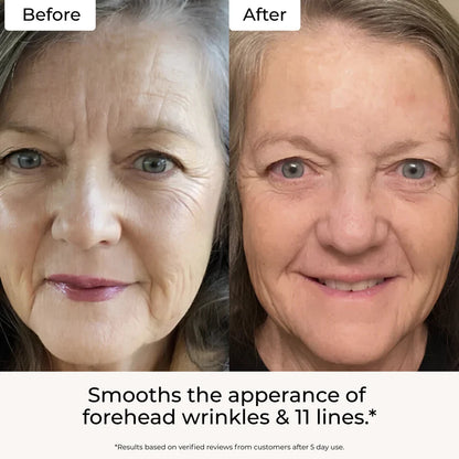 Auna Targeted Fine Line Primer